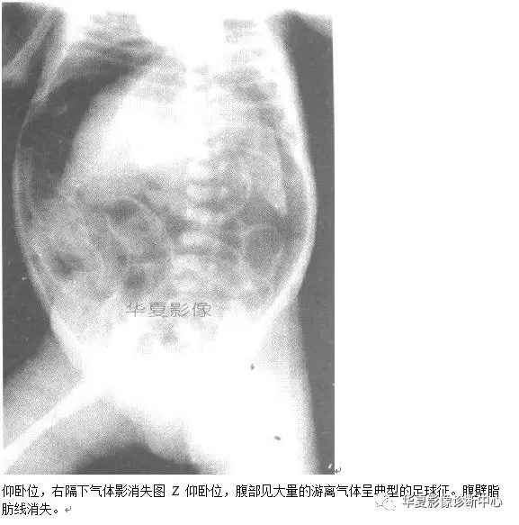 腹部疾病影像(腹部疾病影像知识点)