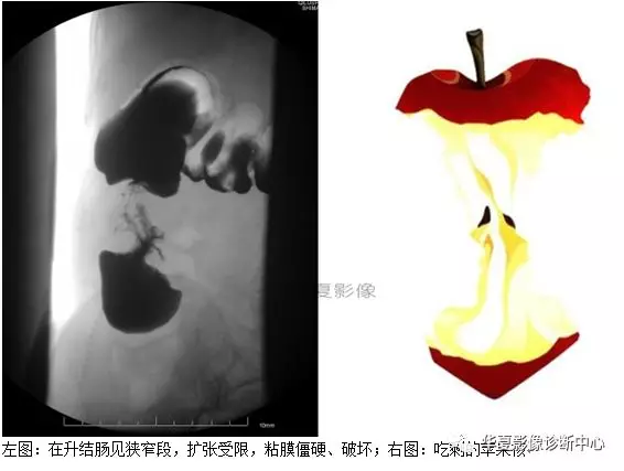 腹部疾病影像(腹部疾病影像知识点)